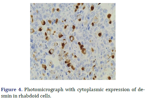 histopathology-cytoplasmic-expression